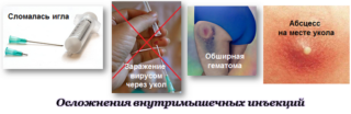 Изображение - Инъекции при коксартрозе тазобедренного сустава oslozhneniya_ot_ukolov-1-320x104