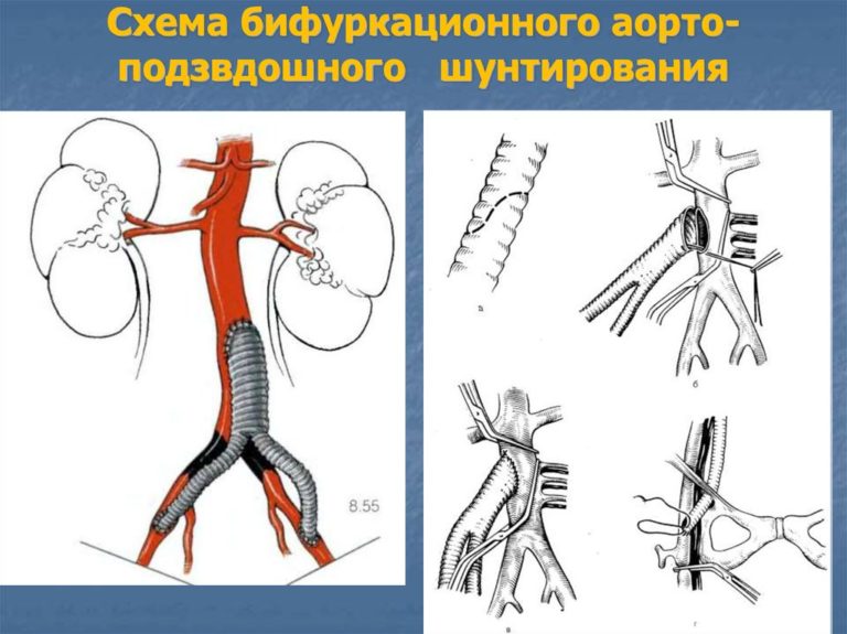 Правая подвздошная область фото