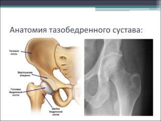 Методы исследования тазобедренных суставов