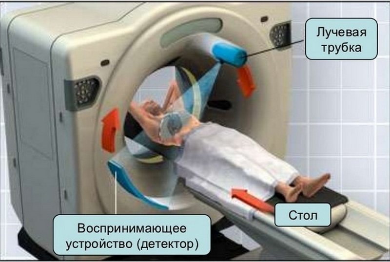 Насколько вредно кт. Компьютерная рентгеновская и магнитно-резонансная томография. Кт и мрт принцип работы. Рентгеновская компьютерная томография. Аппарат мрт (магнитно-резонансная томография).