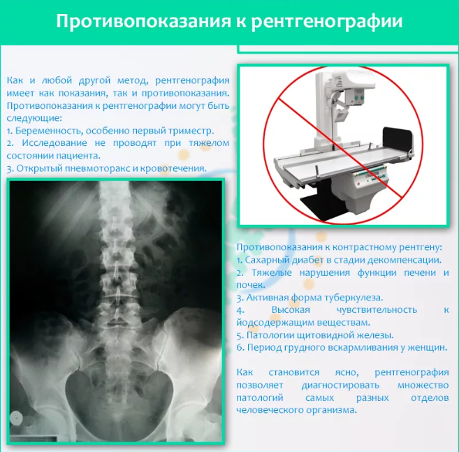 Компьютерная томография тазобедренного сустава что показывает