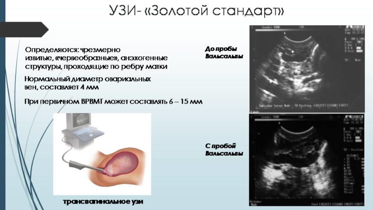 Фото болезни влагалища