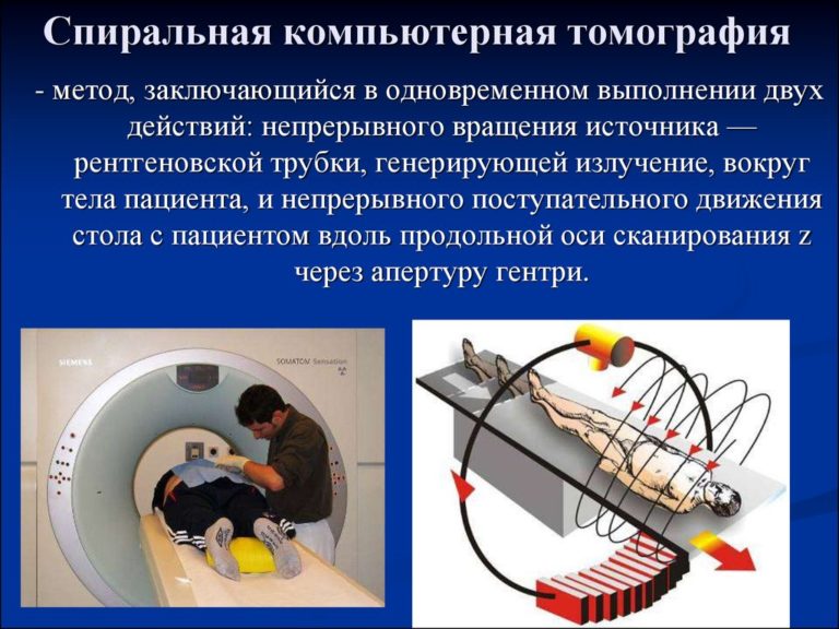 В каких случаях показана компьютерная рентгеновская томография пораженного сустава тест