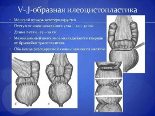 Код мкб нарушение функции тазовых органов thumbnail
