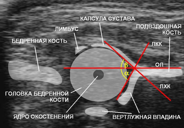 Как делается рентген тазобедренного сустава у женщин фото пошагово