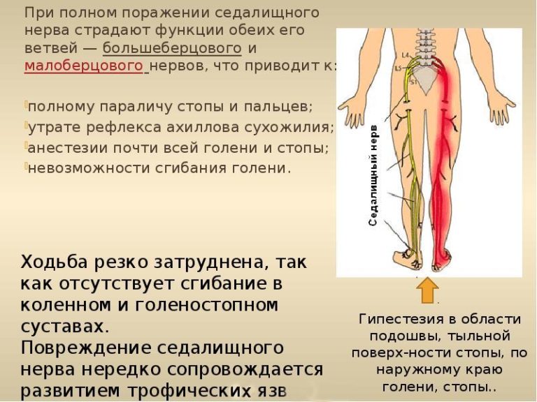 Защемление нерва в тазобедренном суставе: причины, симптомы, лечение и ...