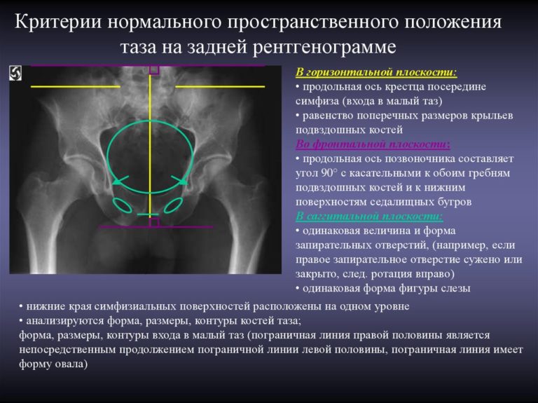 Рентген фото женщин фото