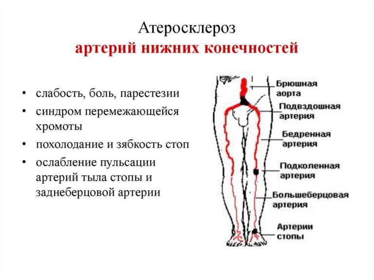 Подвздошная артерия рисунок