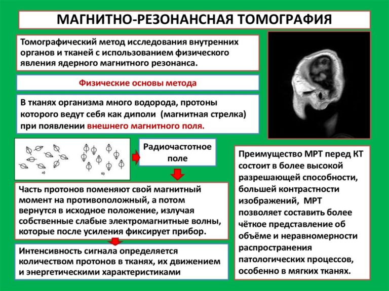 Негативное изображение исследуемого органа на фотопленке