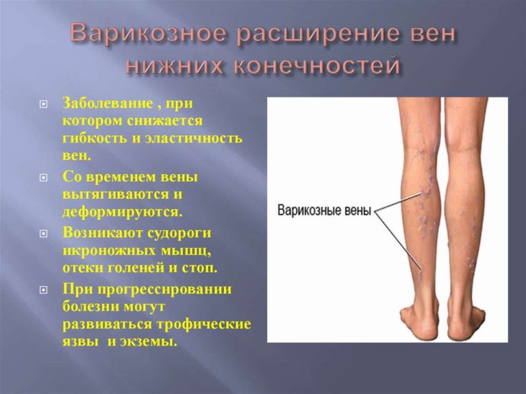 Органы малого таза у женщин что входит картинка