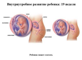Резкие боли внизу живота при беременности 19 недель