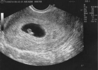 Тянущие боли внизу живота 6 неделя беременности