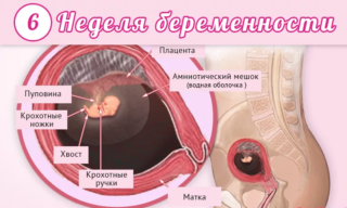 беременность 6 недель болит низ живота как при месячных
