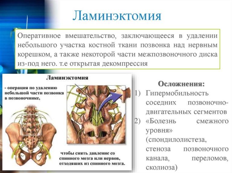 Повреждение нервных стволов при инъекции презентация