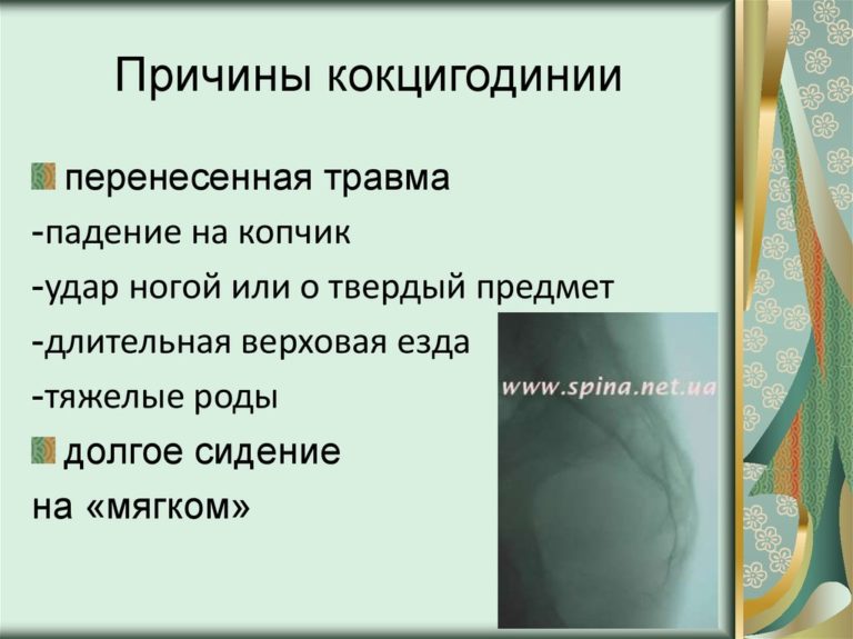 Строение копчика у женщин и хвостик фото