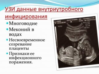 Боль внизу живота у беременных после полового акта thumbnail