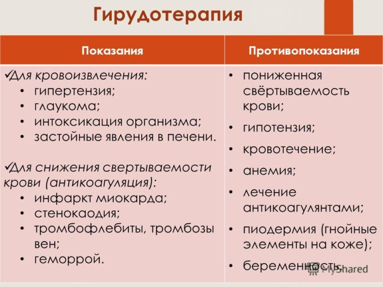 Пиявки при гайморите схема постановки