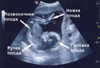 Ноющие боли внизу живота при беременности 19 недель thumbnail