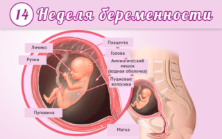 Тянущие боли слева внизу живота 14 неделя беременности