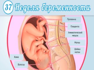 Тянущая боль внизу живота у женщин при беременности на 37 неделе