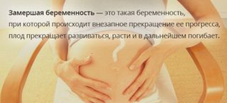 Боль внизу живота слева у женщин при беременности на 20 неделе