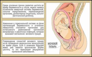 Боль внизу живота при беременности как при 18 недель thumbnail