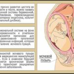 Почему жжет живот при беременности 17