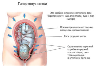 Болит низ живота слева при ходьбе при беременности thumbnail