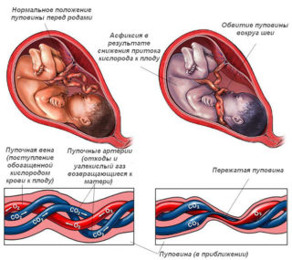 Почему пупок во время беременности чернеет