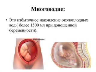 Срок беременности маленький а живот большой почему thumbnail