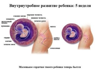 Тянущие боли справа внизу живота на 5 неделе беременности
