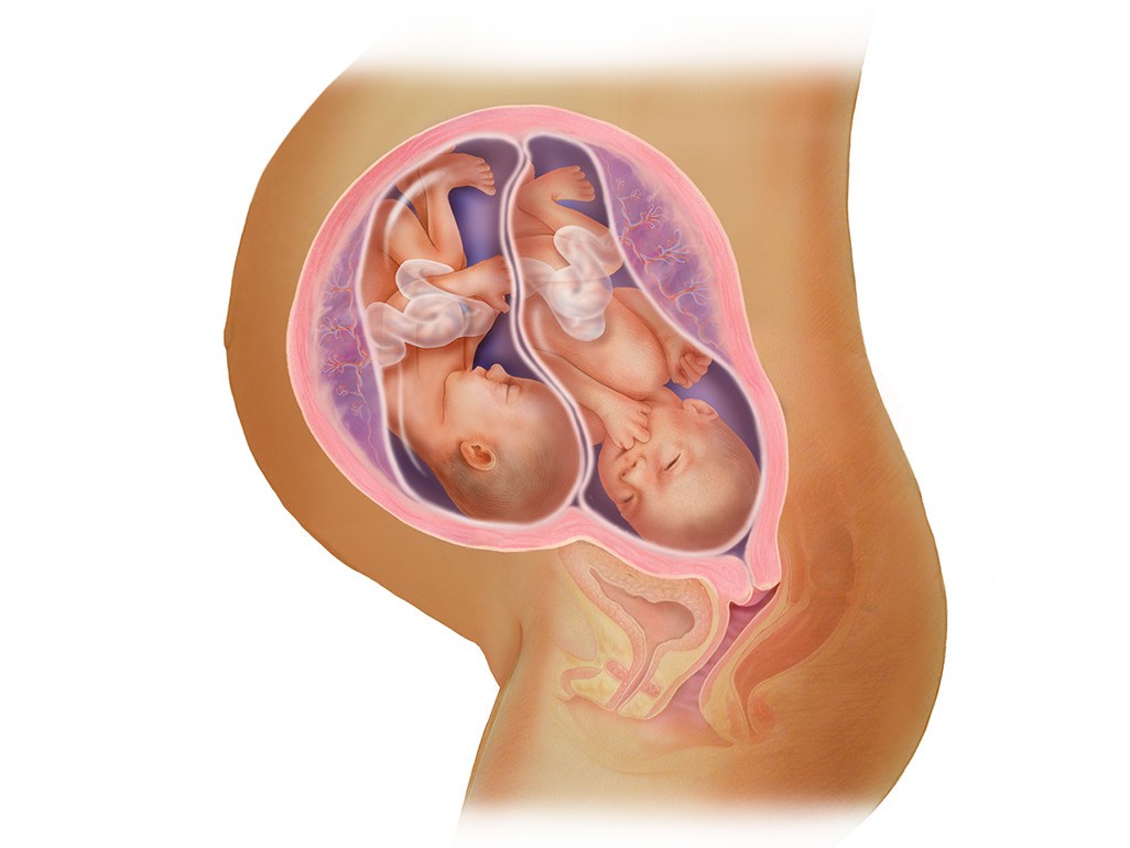 Многоплодная беременность двойня