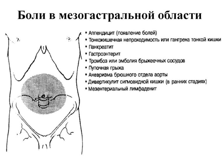 Поперечная раскачка автомобиля причины