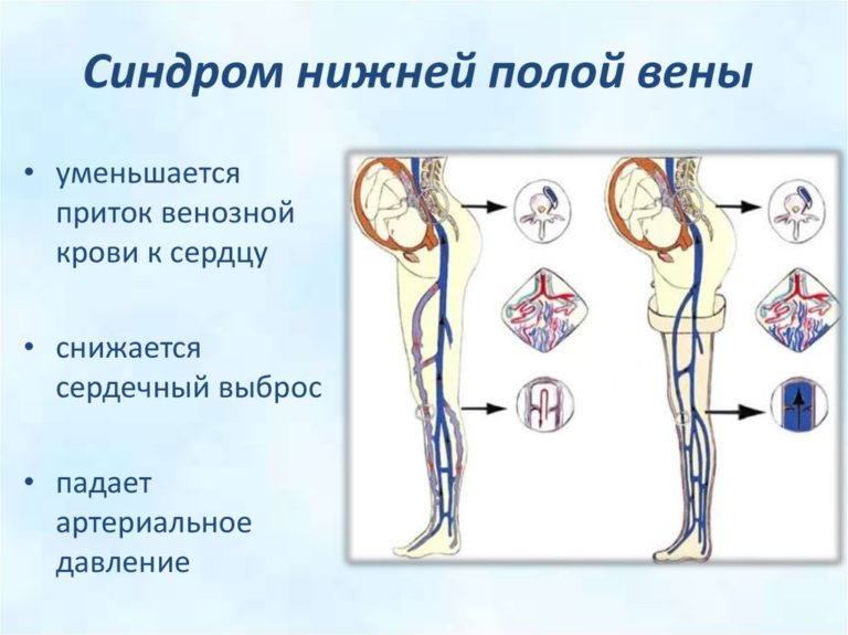 Где находится периферическая вена у человека фото