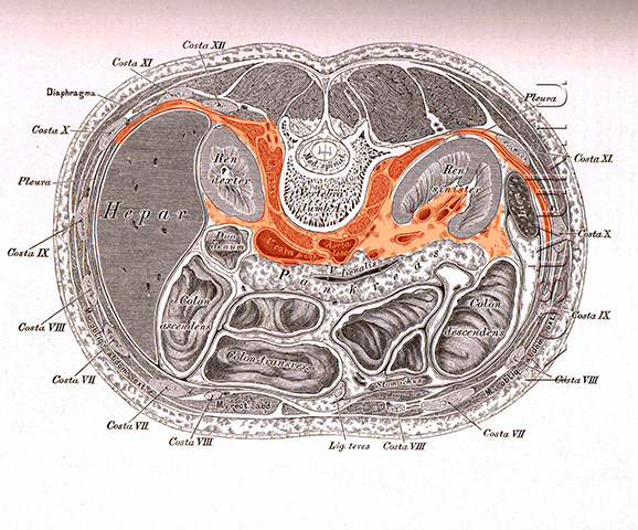 Сагиттальный распил забрюшинного пространства схема