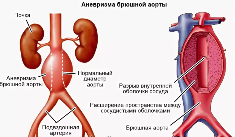 Анус здорового человека фото