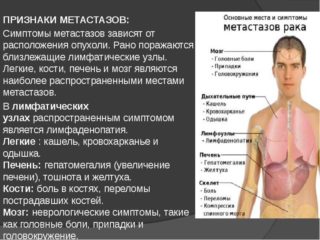 Метастазы брюшной полости и желудка лечение