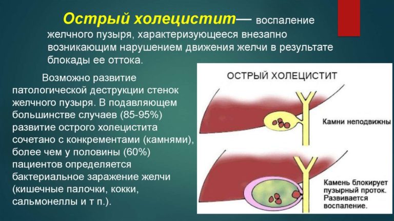 Боль одновременно в правом и левом подреберье: причины, диагностика ...