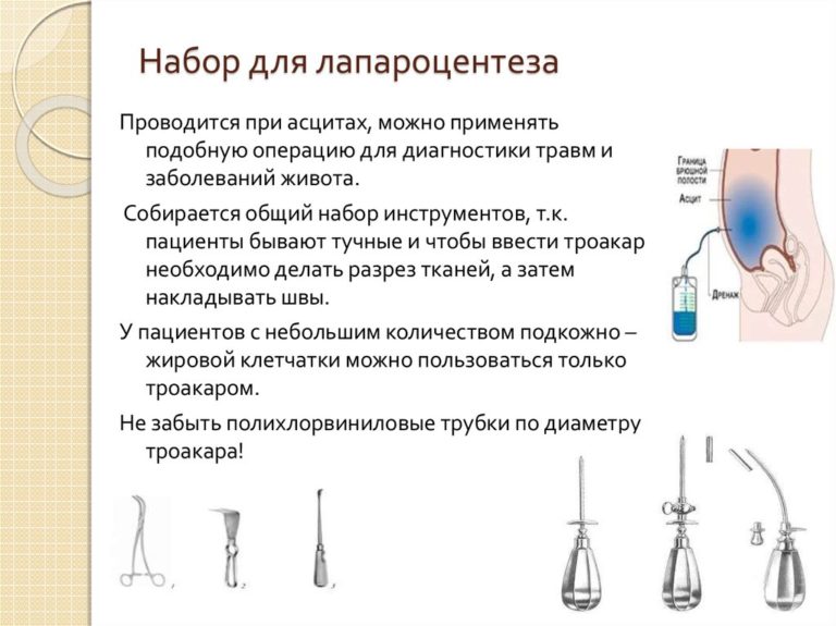 Лапароцентез брюшной полости при асците: показания, техника выполнения ...