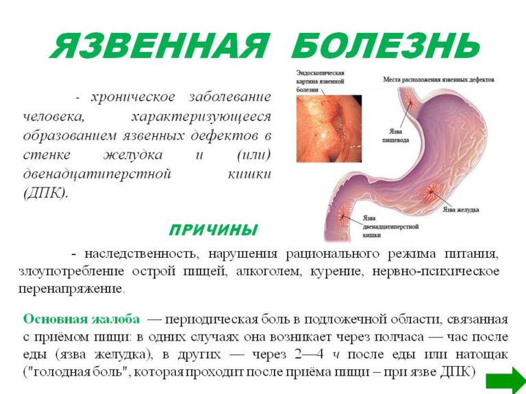 Подреберье где находится фото