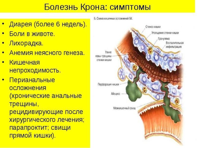 Локализация боли в животе в картинках