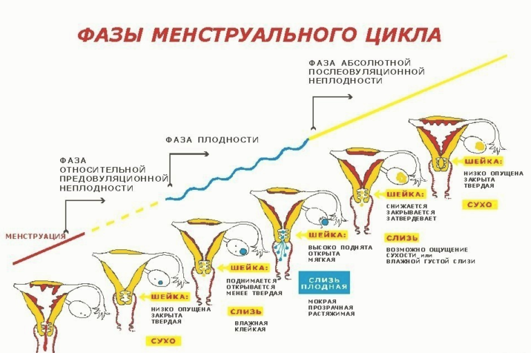 На 5 день после овуляции тянет низ живота как перед месячными и выделения белые