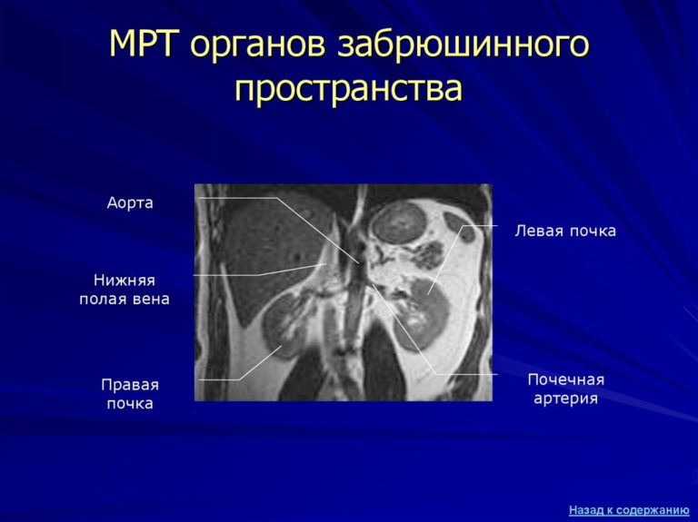 Строение брюшной полости у женщин рисунок с описанием