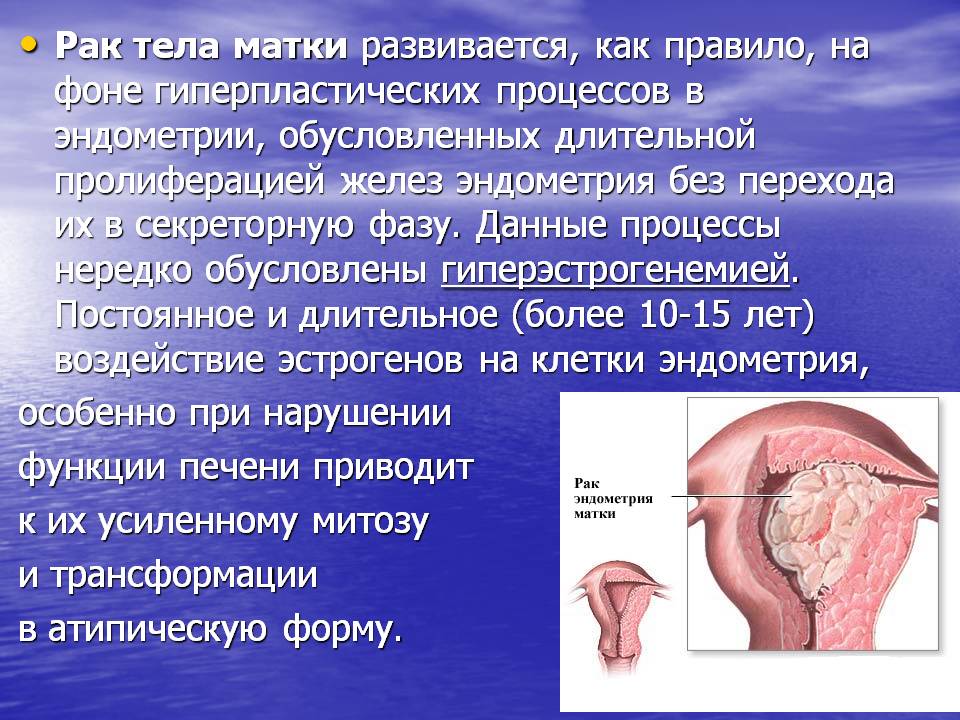 Новообразование эндометрия. Опухоль эндометрия матки. Онкология эндометрия матки.