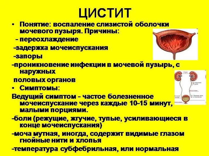 Цистит После Секса