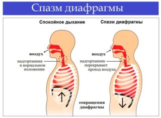 Болит спина в области диафрагмы