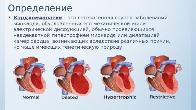 Где находятся легкие у человека фото спереди у женщин