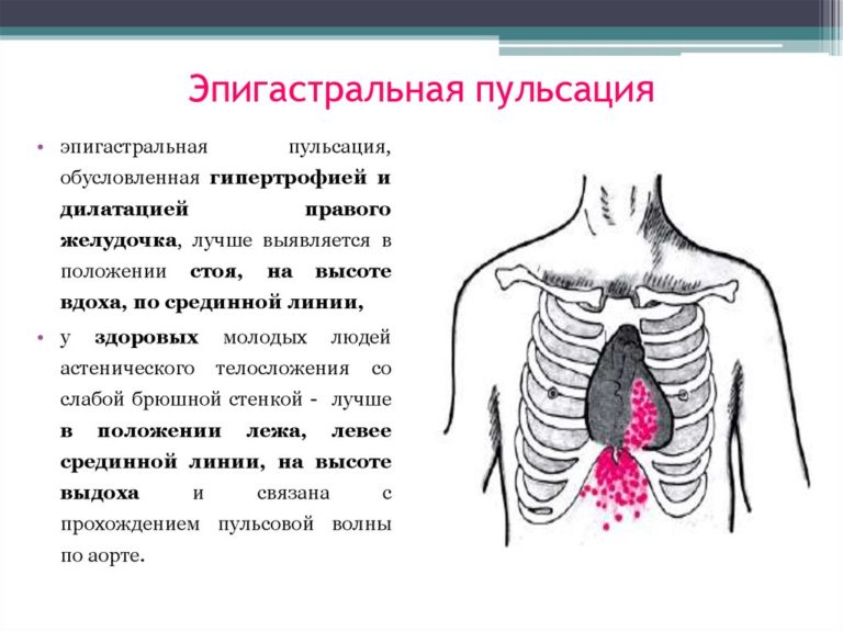 Область эпигастрия где находится у человека фото