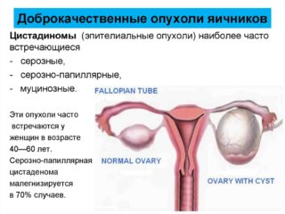 Выделения у женщин с болью внизу живота лечение thumbnail