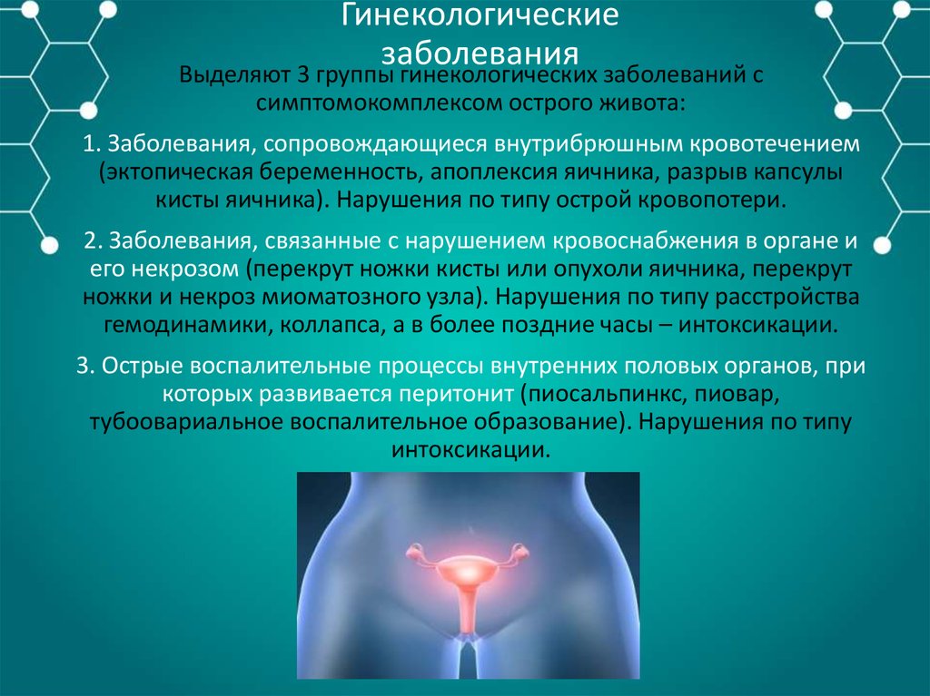 Заболевания женской репродуктивной системы презентация